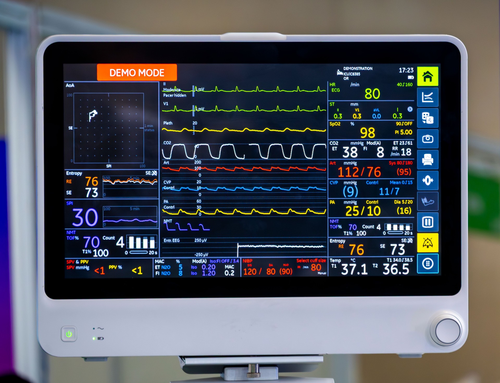 Un monitor elettronico avanzato per il monitoraggio del paziente visualizza parametri critici come la frequenza cardiaca, l'ossigeno e la pressione sanguigna.